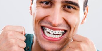 Ortodonție pentru adulți: niciodată nu este prea târziu pentru aparat dentar